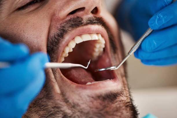 Best Emergency Tooth Extraction  in Peosta, IA