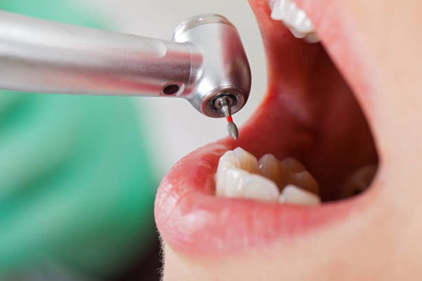 Best Tooth Infection Emergency Dentist  in Peosta, IA